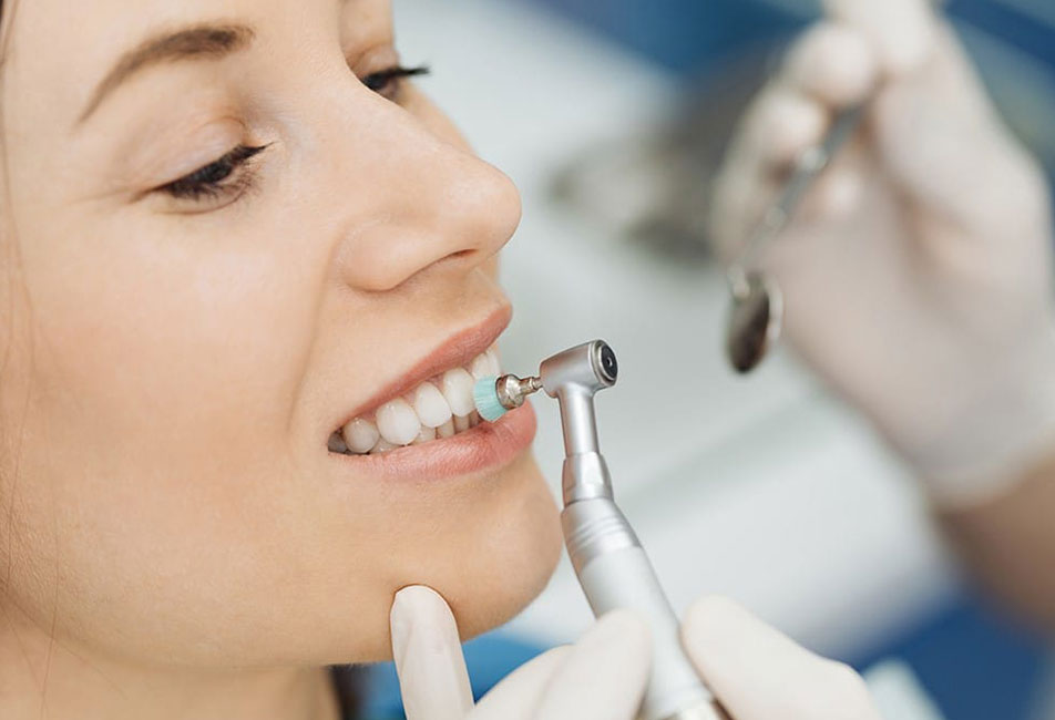 Cavex Prophypaste | Polierpaste